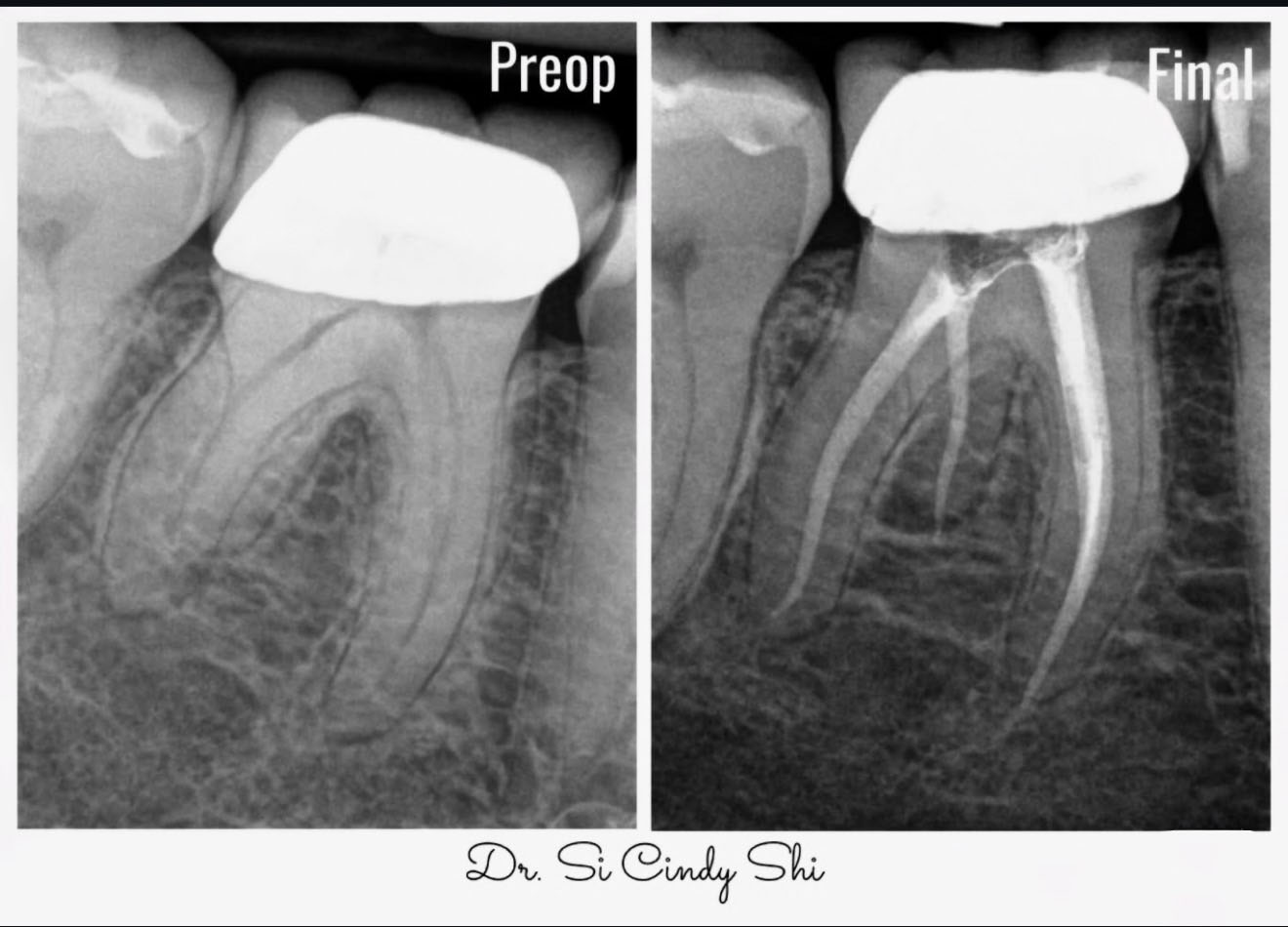 Elite Endodontics Studio patient experience